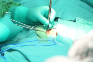 Opération de la hernie inguinale à la clinique Saint-Luc à Bouge en Wallonie 