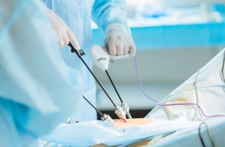 Jusqu’ou peut-on aller dans la chirurgie mini-invasive en chirurgie colorectale en Belgique ?